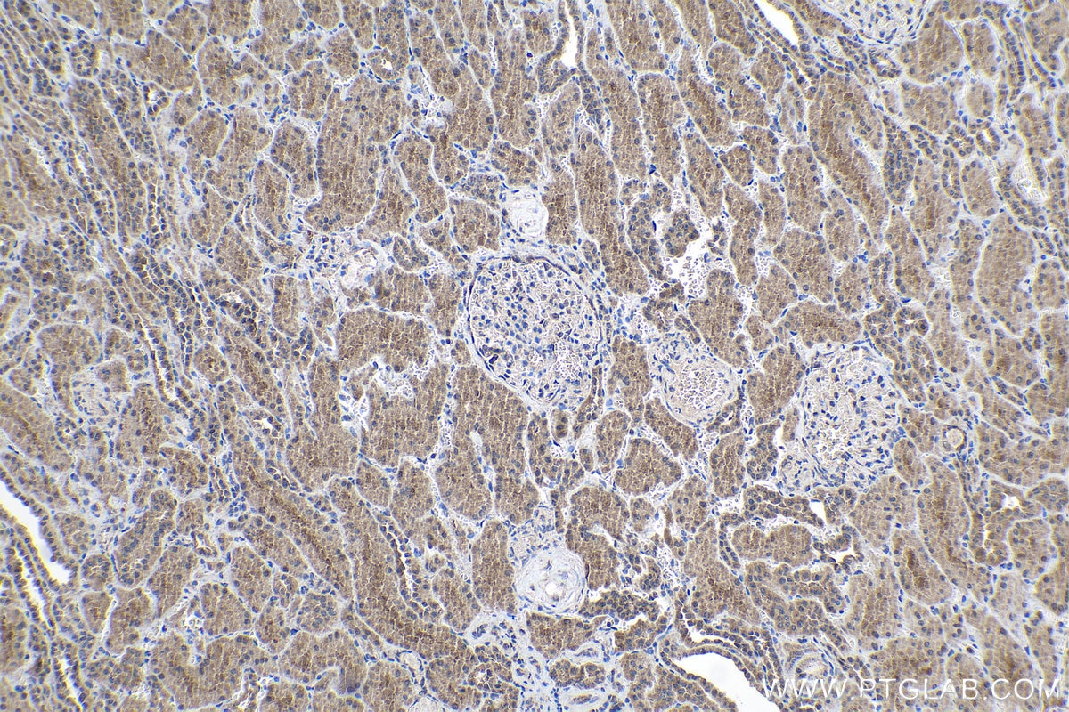 Immunohistochemical analysis of paraffin-embedded human kidney tissue slide using KHC1062 (NOTCH2 IHC Kit).