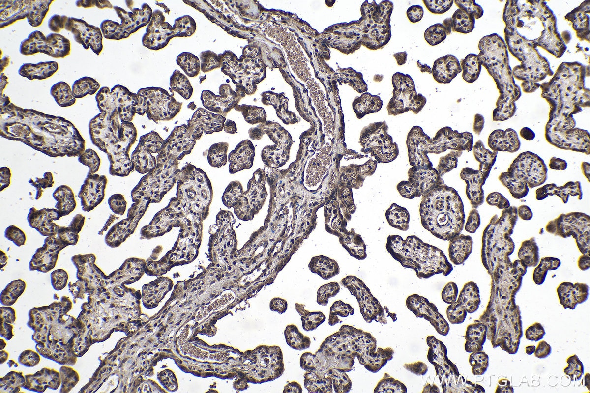 Immunohistochemical analysis of paraffin-embedded human placenta tissue slide using KHC1062 (NOTCH2 IHC Kit).