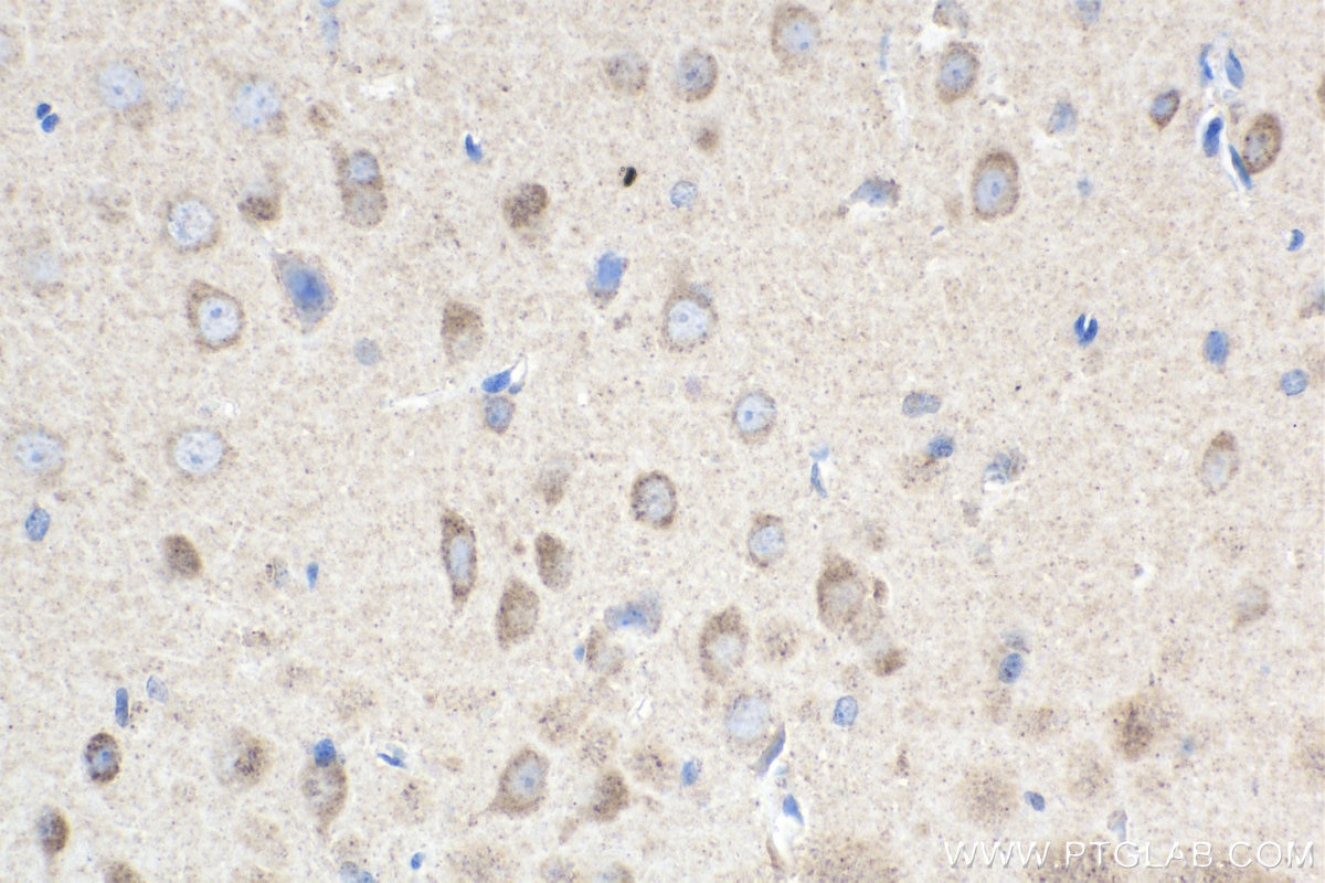 Immunohistochemical analysis of paraffin-embedded rat brain tissue slide using KHC1954 (NOX4 IHC Kit).