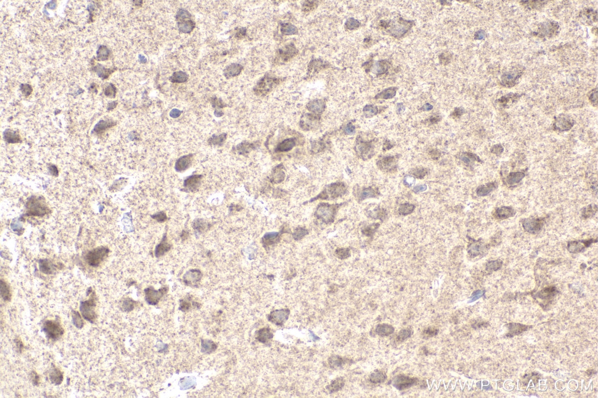 Immunohistochemical analysis of paraffin-embedded mouse brain tissue slide using KHC1954 (NOX4 IHC Kit).