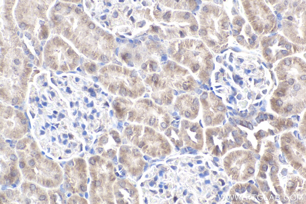 Immunohistochemical analysis of paraffin-embedded rat kidney tissue slide using KHC1954 (NOX4 IHC Kit).