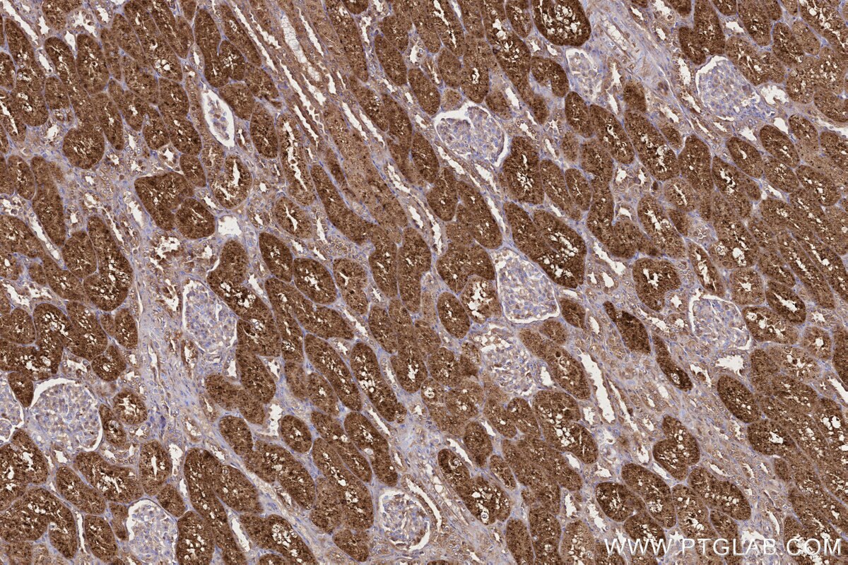 Immunohistochemical analysis of paraffin-embedded human kidney tissue slide using KHC3237 (NPC2 IHC Kit).