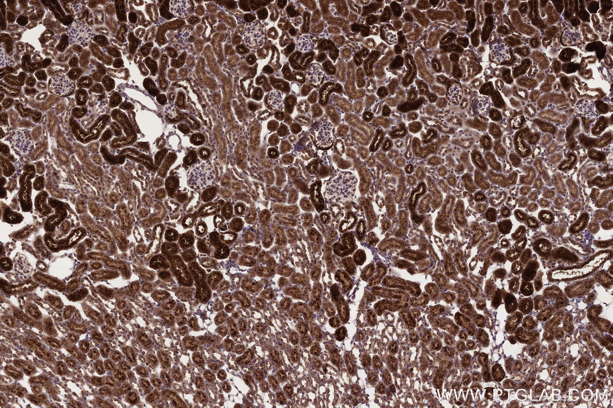 Immunohistochemical analysis of paraffin-embedded mouse kidney tissue slide using KHC3237 (NPC2 IHC Kit).
