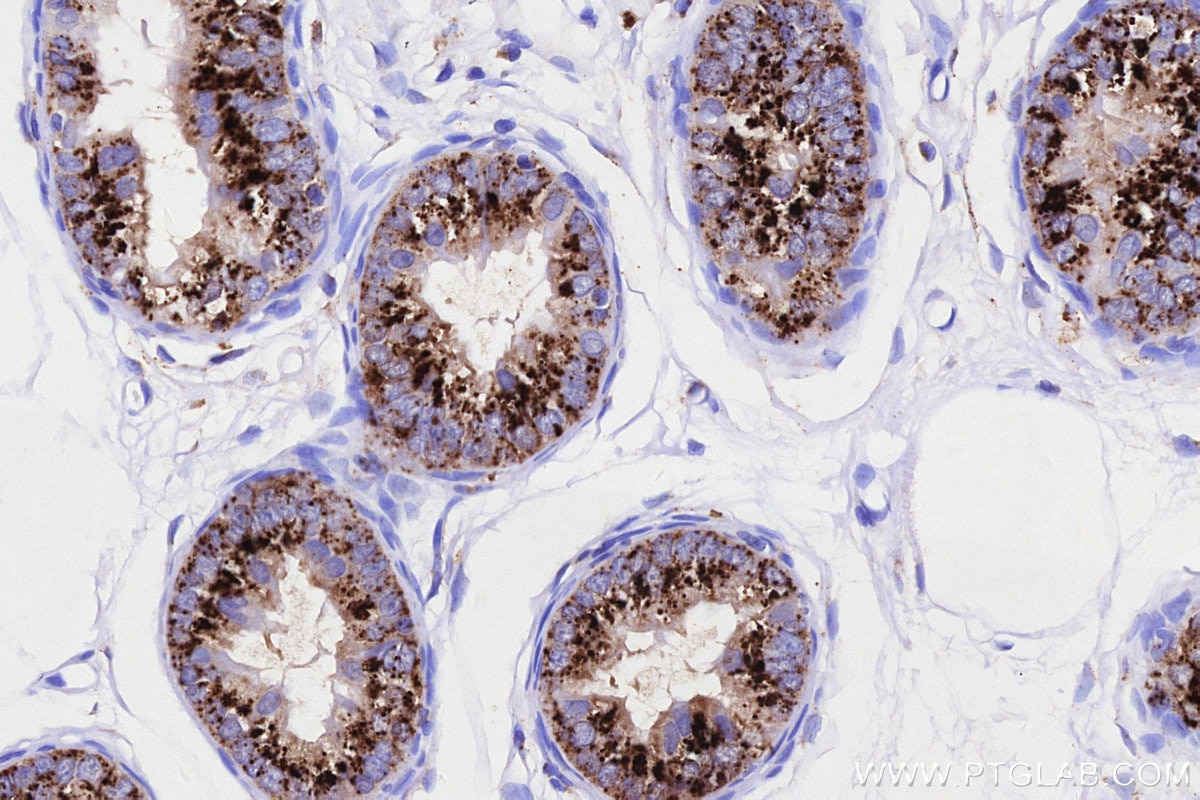 Immunohistochemical analysis of paraffin-embedded rat epididymis tissue slide using KHC3237 (NPC2 IHC Kit).