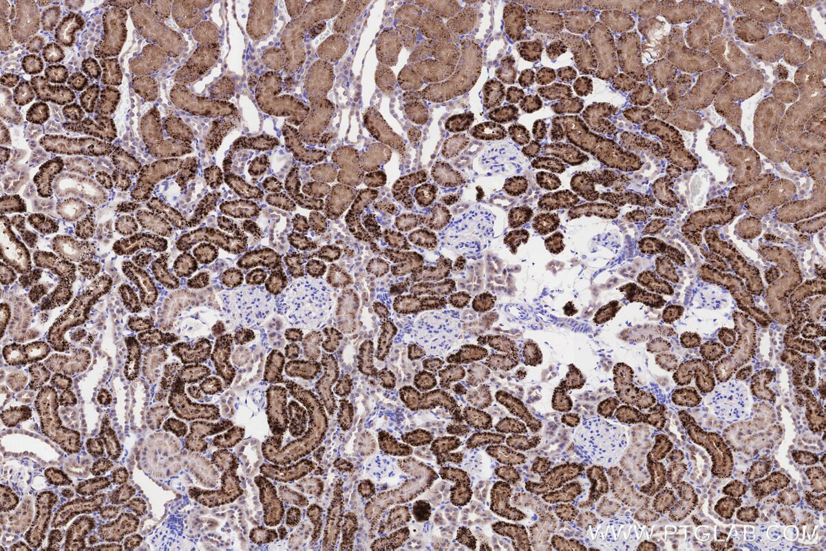 Immunohistochemical analysis of paraffin-embedded rat kidney tissue slide using KHC3237 (NPC2 IHC Kit).