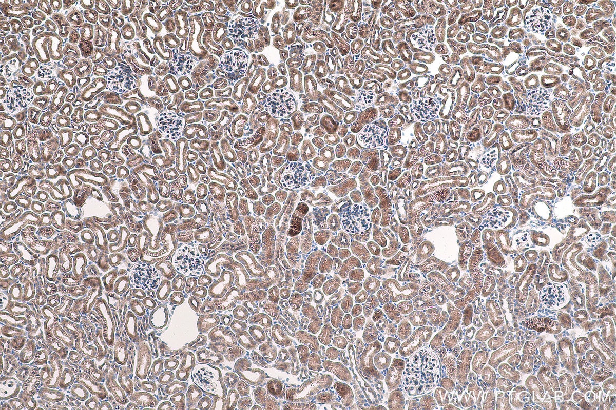 Immunohistochemical analysis of paraffin-embedded mouse kidney tissue slide using KHC1004 (NPLOC4 IHC Kit).