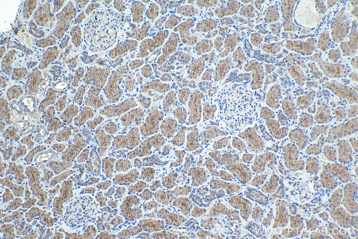 Immunohistochemical analysis of paraffin-embedded human kidney tissue slide using KHC1004 (NPLOC4 IHC Kit).