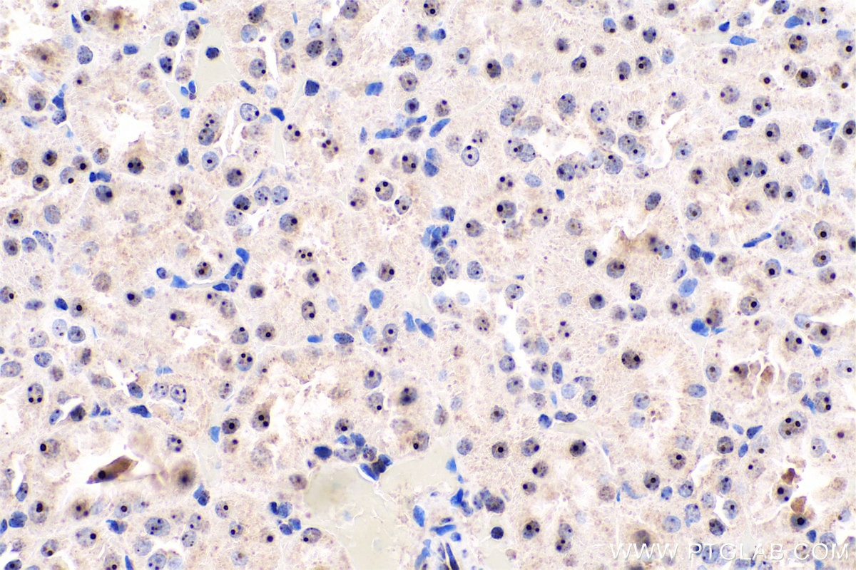 Immunohistochemical analysis of paraffin-embedded rat kidney tissue slide using KHC0621 (B23/NPM1 IHC Kit).