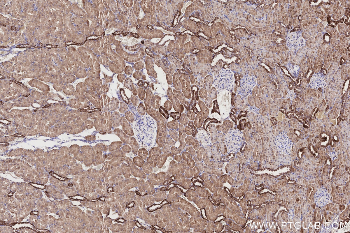 Immunohistochemical analysis of paraffin-embedded rat kidney tissue slide using KHC3188 (NQO2 IHC Kit).