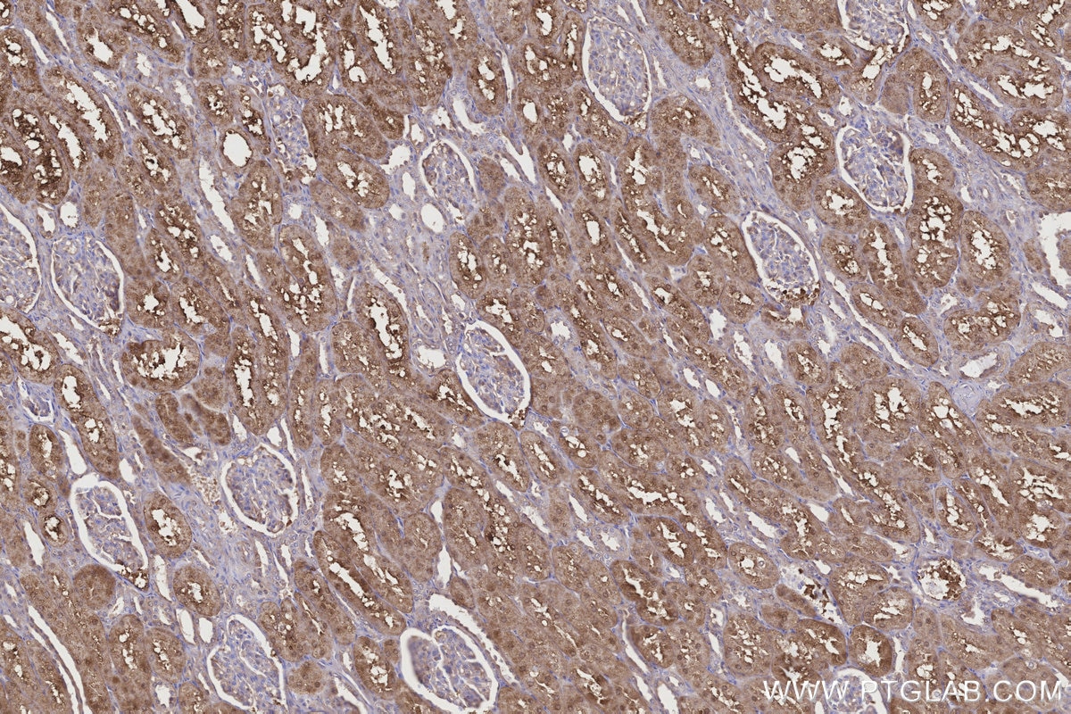 Immunohistochemical analysis of paraffin-embedded human kidney tissue slide using KHC3188 (NQO2 IHC Kit).