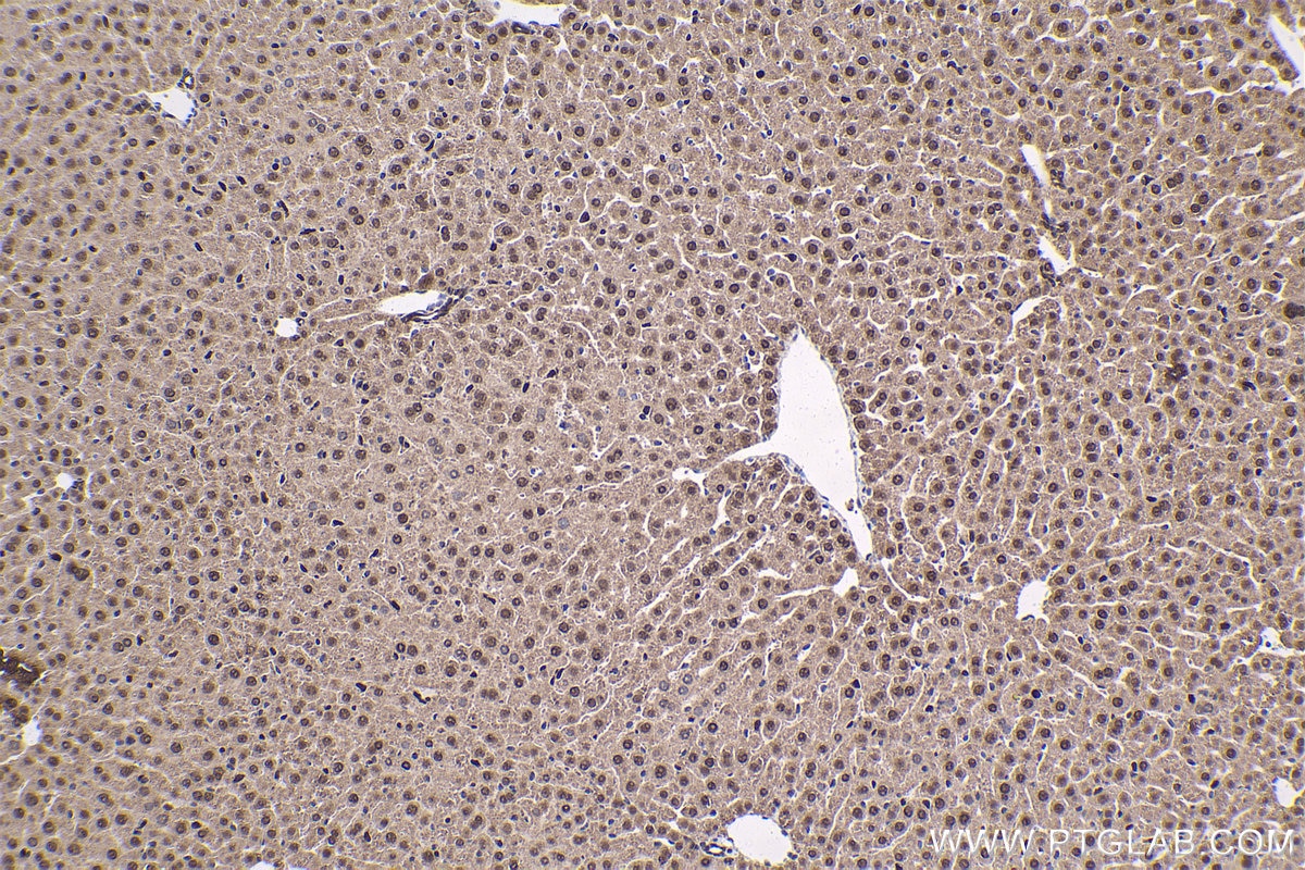 Immunohistochemical analysis of paraffin-embedded mouse liver tissue slide using KHC1702 (NR1H3 IHC Kit).