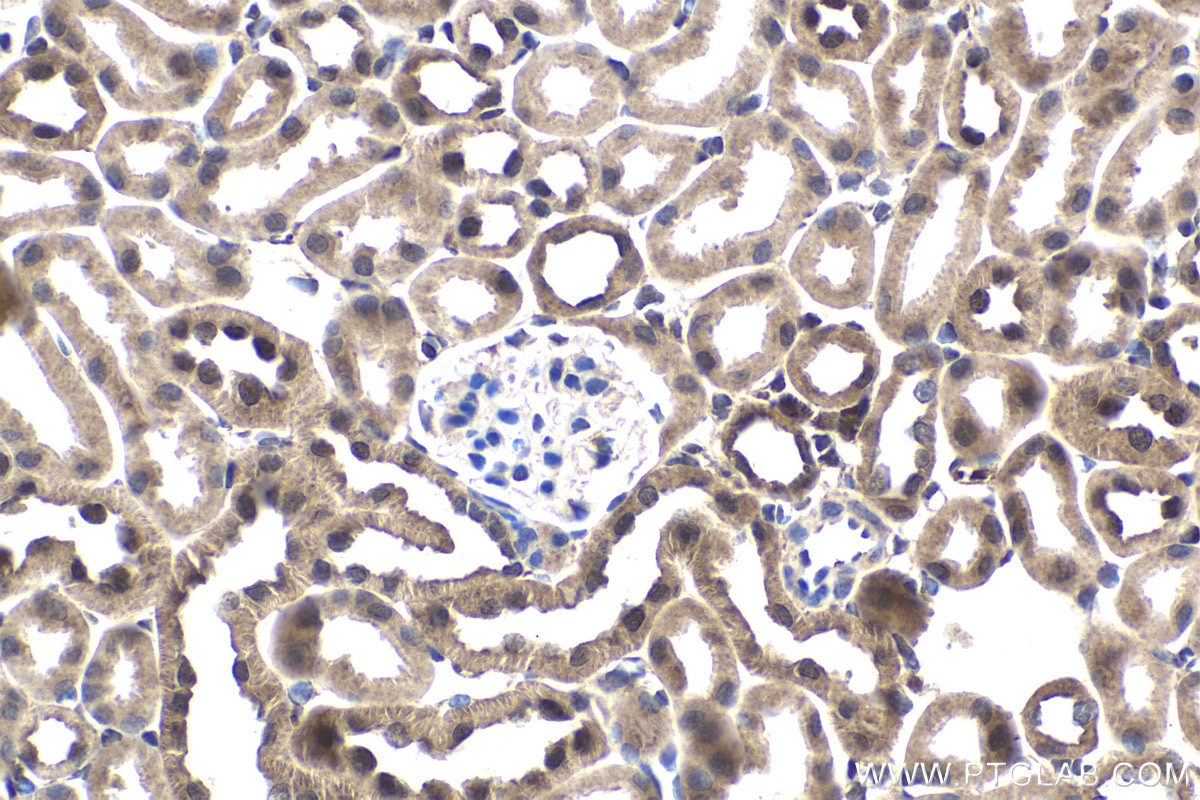 Immunohistochemical analysis of paraffin-embedded mouse kidney tissue slide using KHC1744 (NR1I3 IHC Kit).