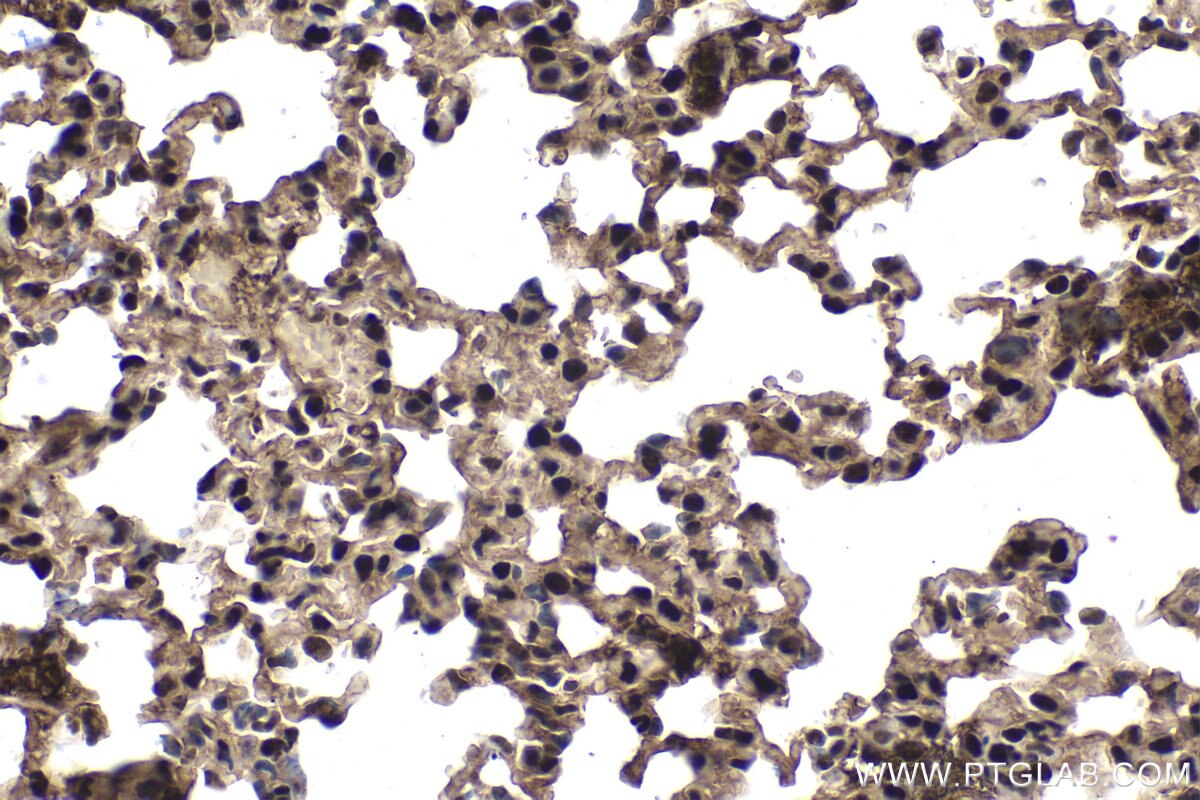 Immunohistochemical analysis of paraffin-embedded mouse lung tissue slide using KHC1507 (NR3C1 IHC Kit).