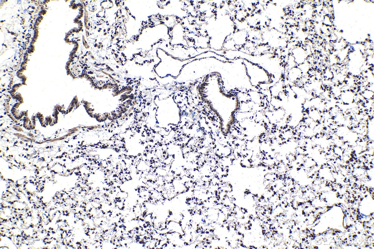 Immunohistochemical analysis of paraffin-embedded rat lung tissue slide using KHC1507 (NR3C1 IHC Kit).