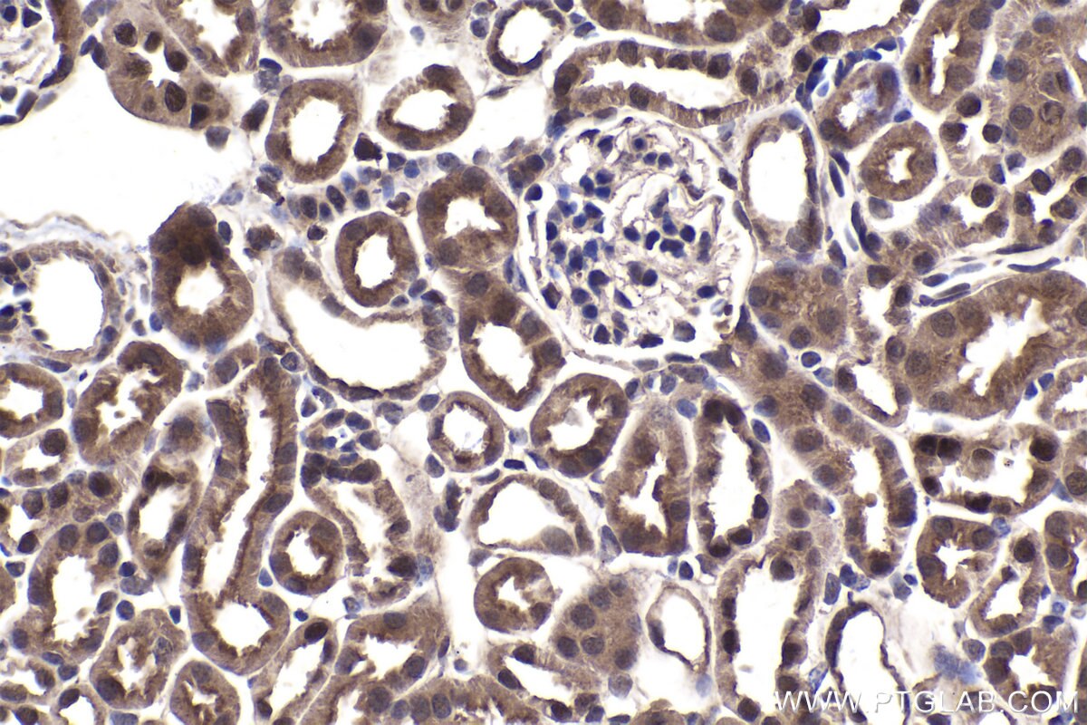 Immunohistochemical analysis of paraffin-embedded mouse kidney tissue slide using KHC1514 (NR3C2 IHC Kit).