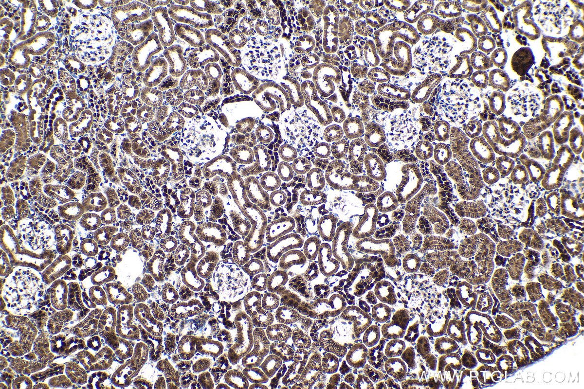 Immunohistochemical analysis of paraffin-embedded rat kidney tissue slide using KHC1514 (NR3C2 IHC Kit).
