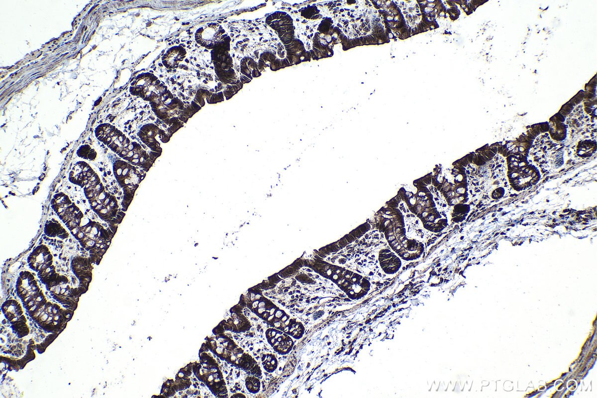 Immunohistochemical analysis of paraffin-embedded rat colon tissue slide using KHC1558 (NR4A1 IHC Kit).