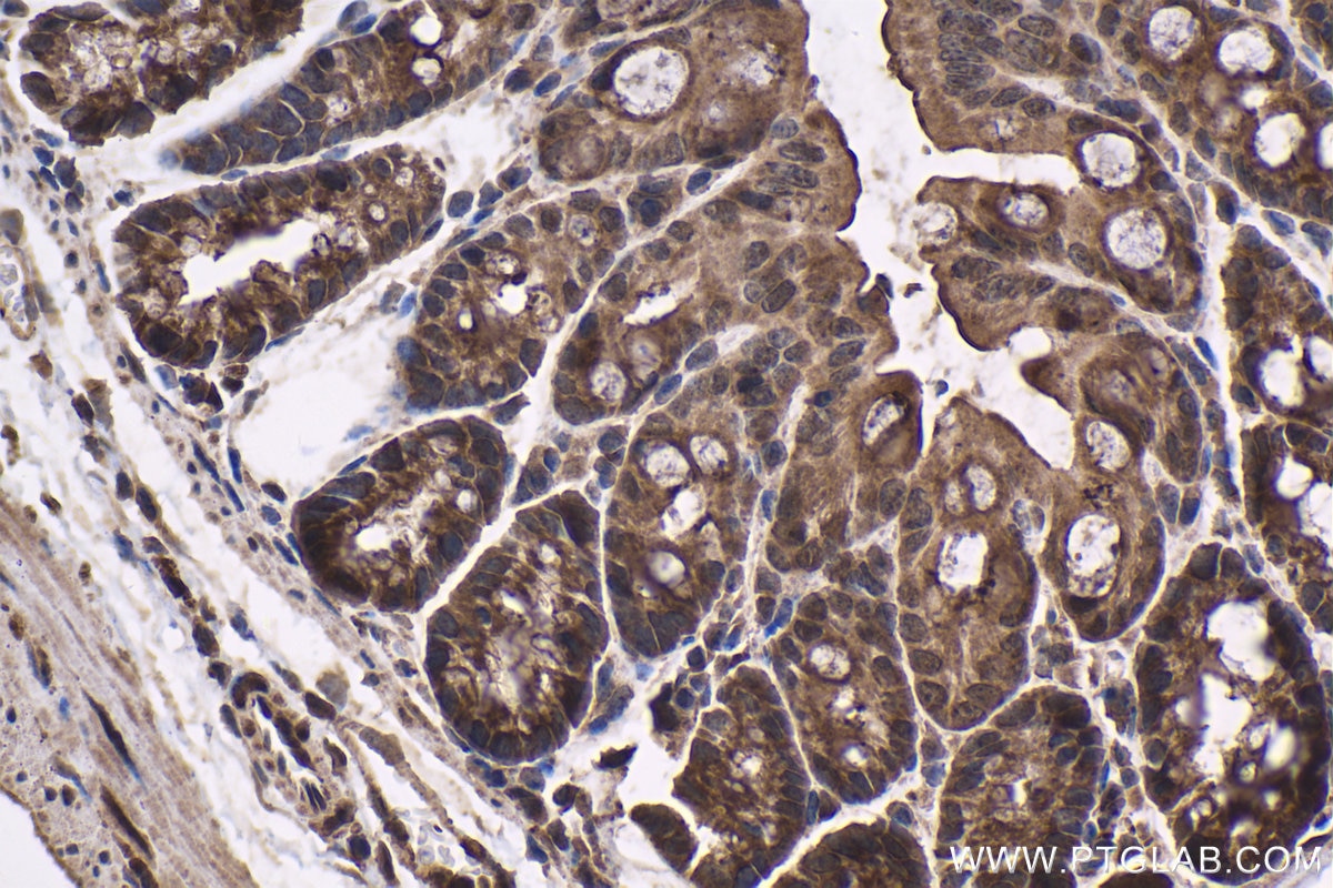 Immunohistochemical analysis of paraffin-embedded mouse colon tissue slide using KHC1558 (NR4A1 IHC Kit).