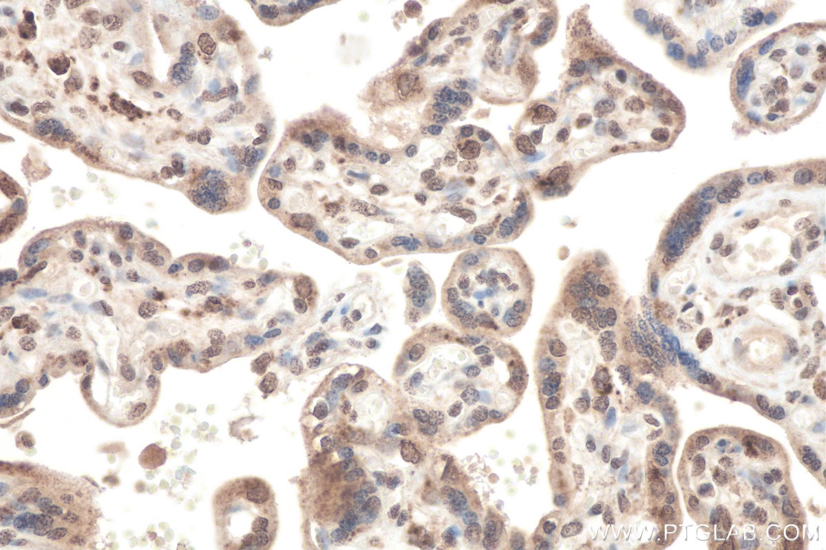 Immunohistochemical analysis of paraffin-embedded human placenta tissue slide using KHC0803 (NR4A2 IHC Kit).