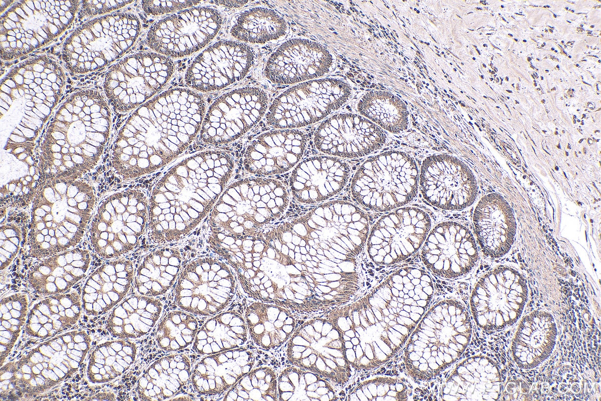 Immunohistochemical analysis of paraffin-embedded human colon cancer(NAT) tissue slide using KHC0279 (NRAS IHC Kit).