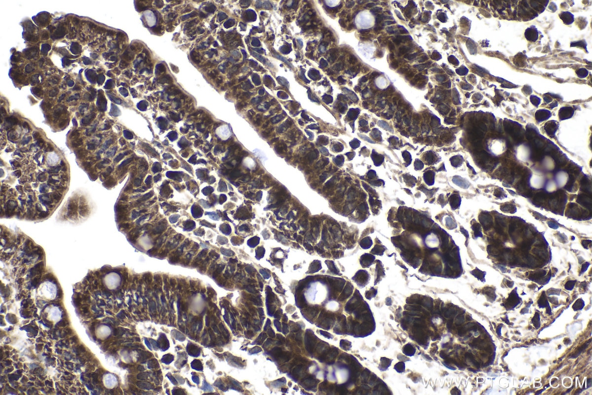 Immunohistochemical analysis of paraffin-embedded mouse small intestine tissue slide using KHC1871 (NRBF2 IHC Kit).