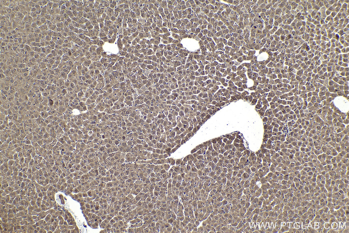 Immunohistochemical analysis of paraffin-embedded mouse liver tissue slide using KHC1871 (NRBF2 IHC Kit).