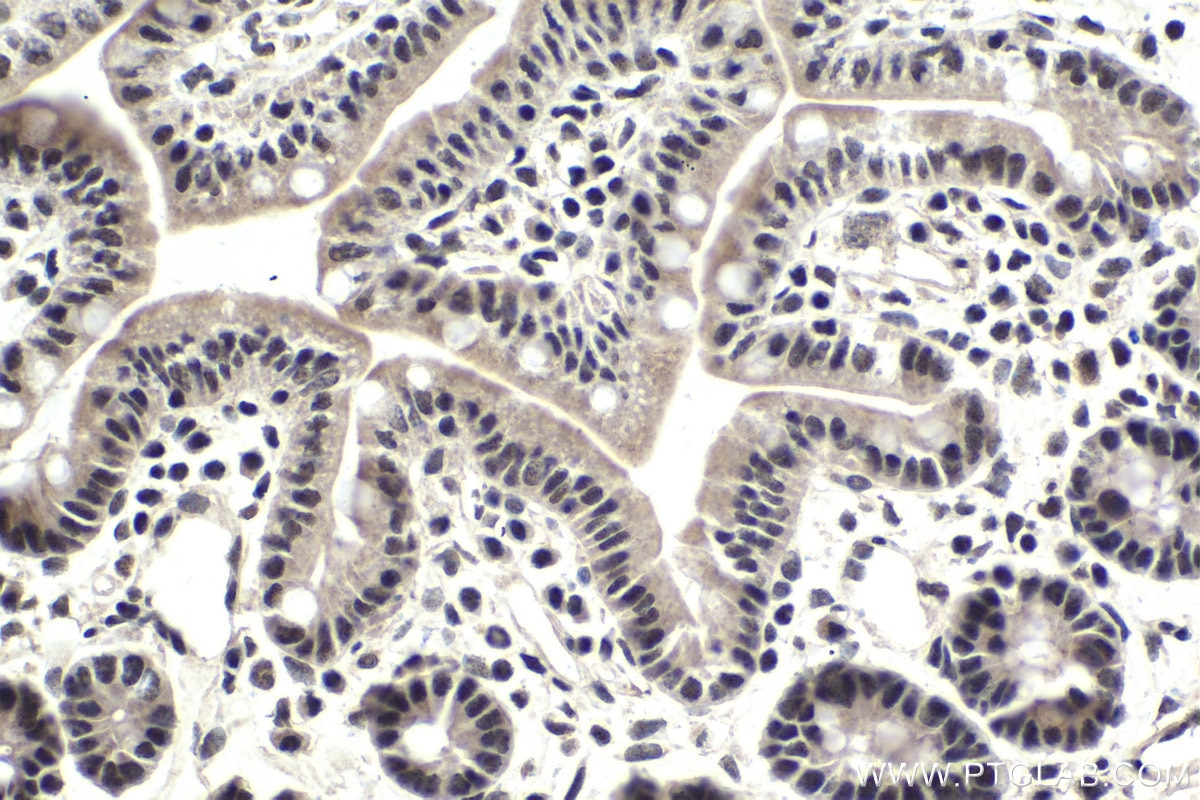 Immunohistochemical analysis of paraffin-embedded mouse small intestine tissue slide using KHC1763 (NRF1 IHC Kit).