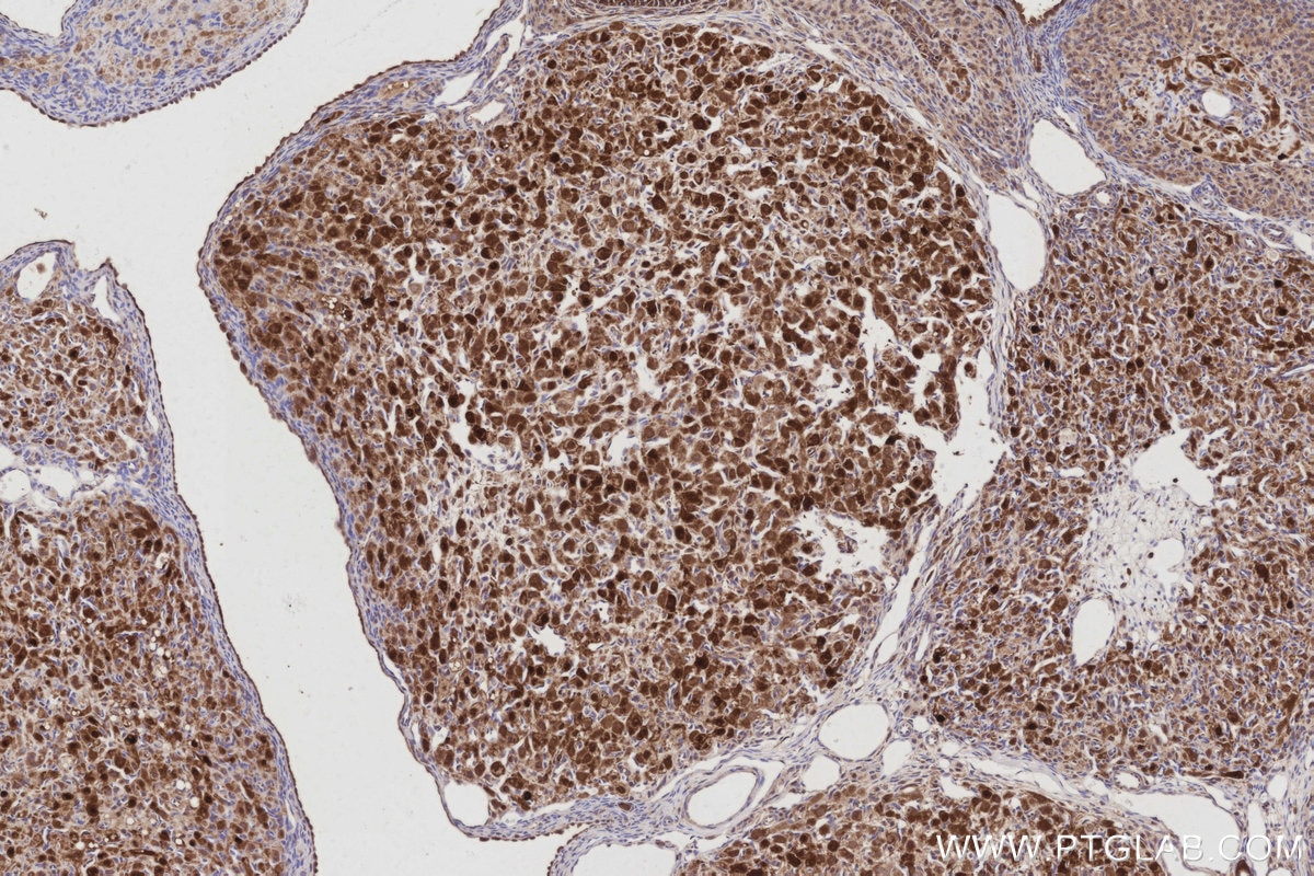 Immunohistochemical analysis of paraffin-embedded rat ovary tissue slide using KHC3045 (NSFL1C IHC Kit). Immunohistochemical analysis of paraffin-embedded rat ovary tissue slide using KHC3045 (NSFL1C IHC Kit).