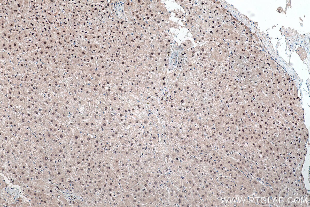 Immunohistochemical analysis of paraffin-embedded human liver tissue slide using KHC0172 (NSUN2 IHC Kit).