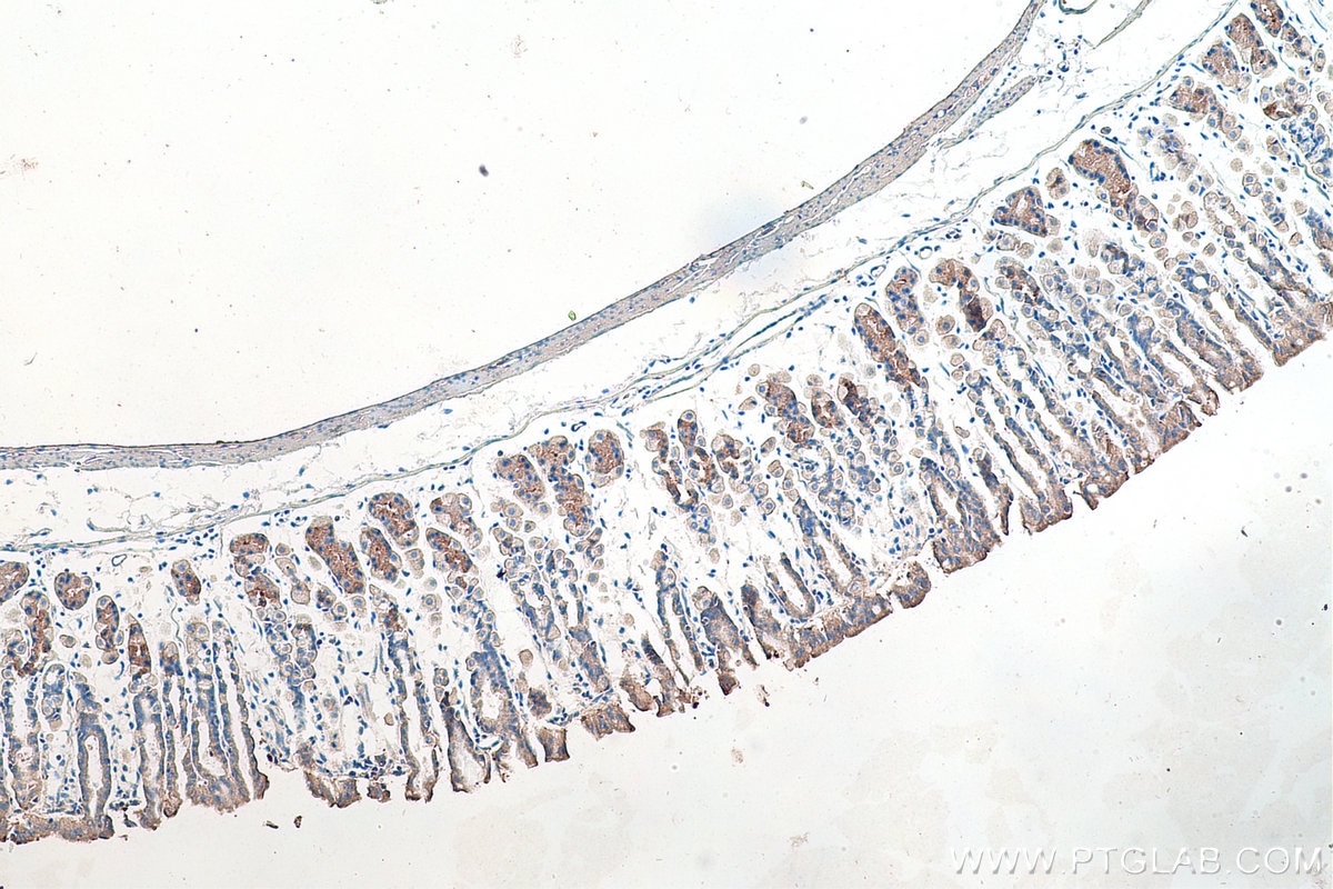 Immunohistochemical analysis of paraffin-embedded mouse stomach tissue slide using KHC0173 (NSUN6 IHC Kit).