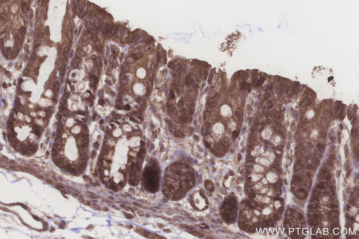 Immunohistochemical analysis of paraffin-embedded rat colon tissue slide using KHC3219 (NT5C2 IHC Kit).