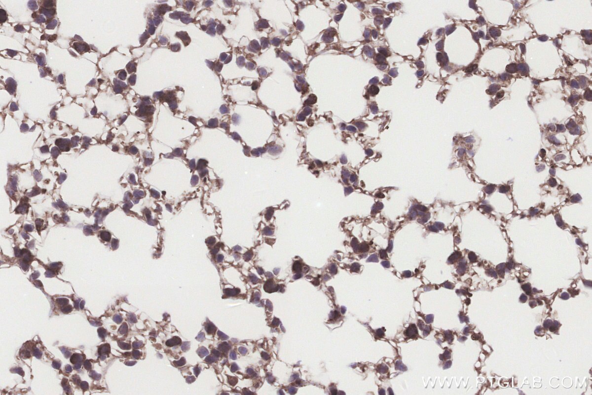 Immunohistochemical analysis of paraffin-embedded mouse lung tissue slide using KHC3226 (NUBP1 IHC Kit).