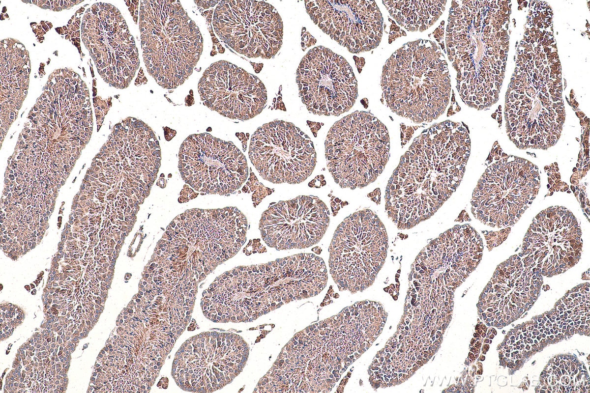 Immunohistochemical analysis of paraffin-embedded mouse testis tissue slide using KHC0946 (NUDT1/MTH1 IHC Kit).