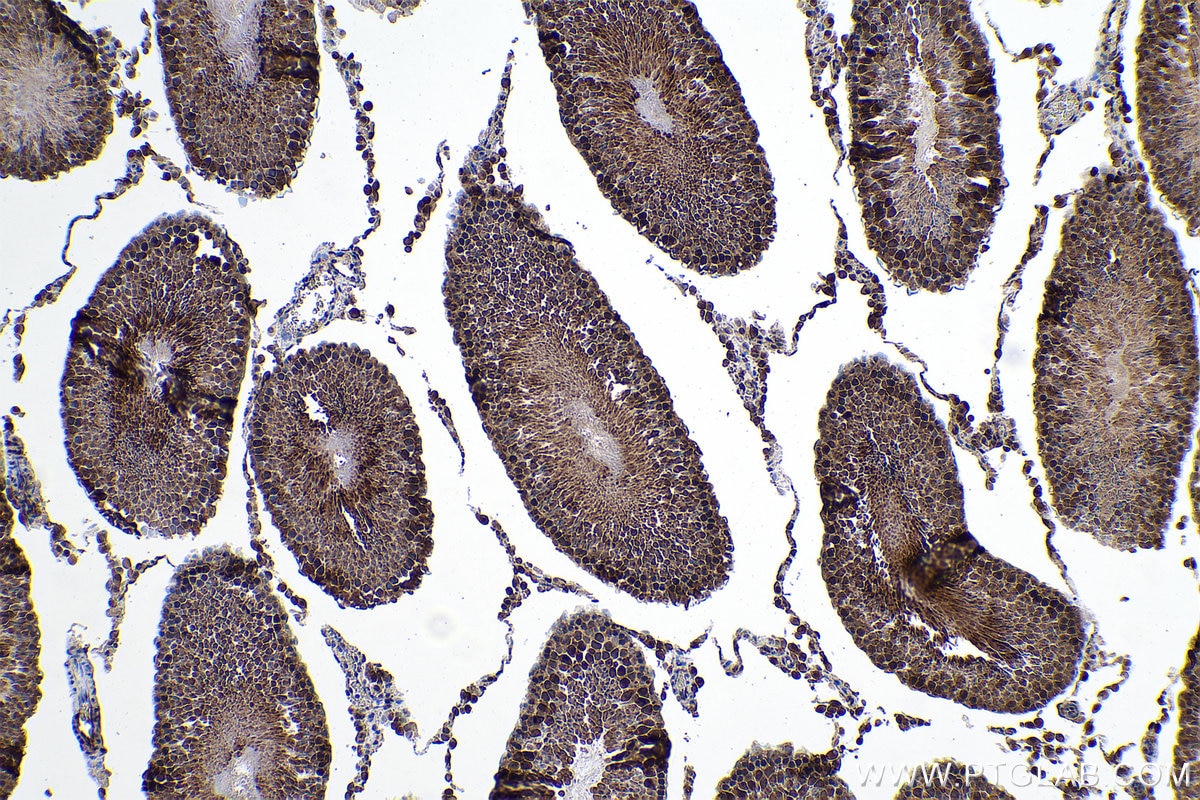 Immunohistochemical analysis of paraffin-embedded rat testis tissue slide using KHC0946 (NUDT1/MTH1 IHC Kit).