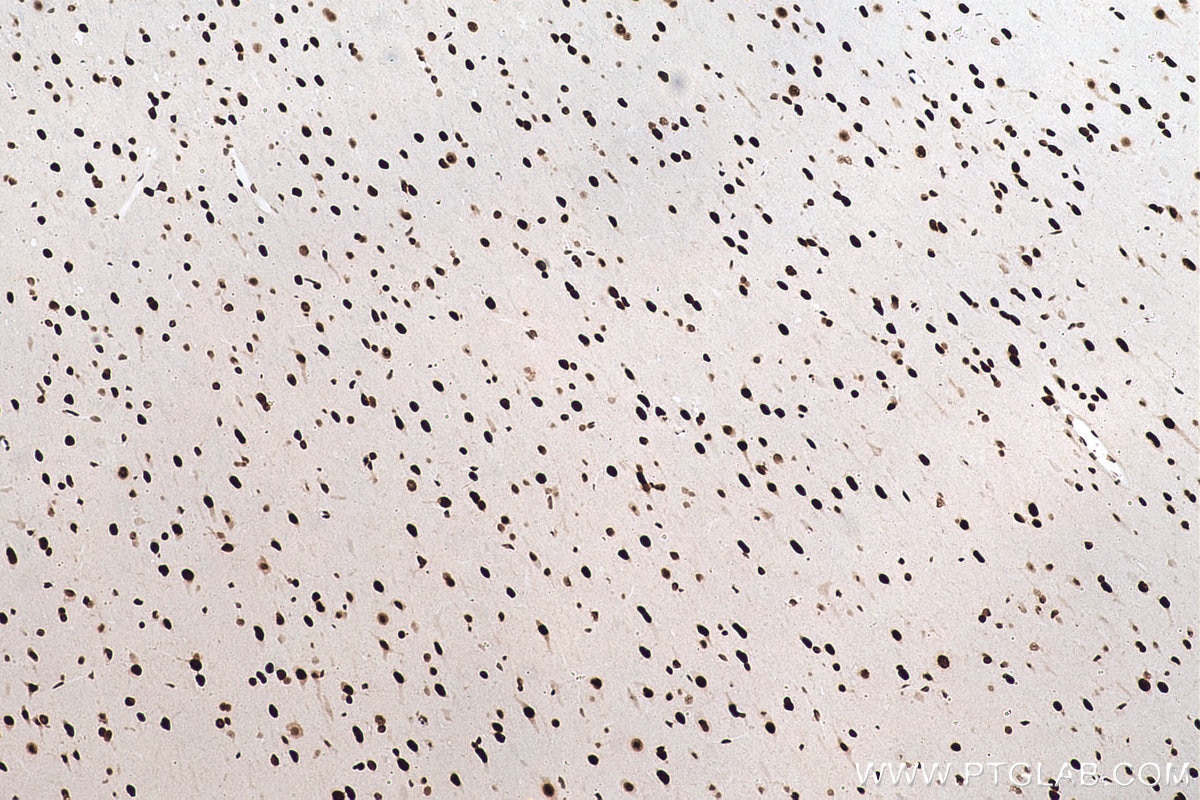 Immunohistochemical analysis of paraffin-embedded rat brain tissue slide using KHC0870 (NUDT21 IHC Kit).