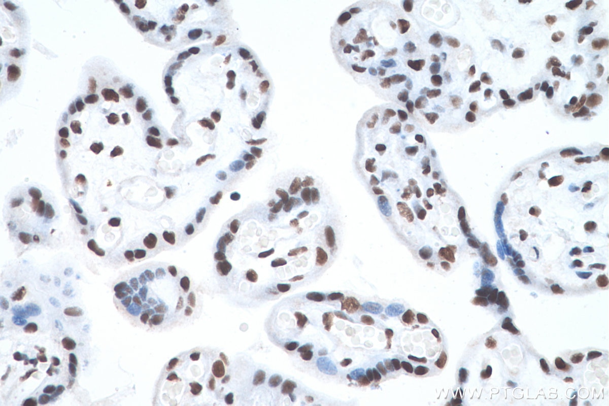 Immunohistochemical analysis of paraffin-embedded human placenta tissue slide using KHC0870 (NUDT21 IHC Kit).