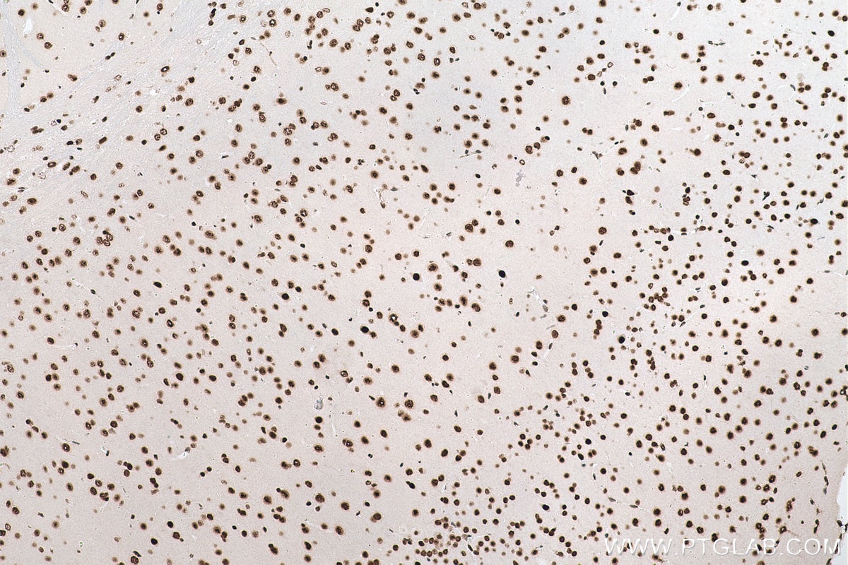 Immunohistochemical analysis of paraffin-embedded mouse brain tissue slide using KHC0870 (NUDT21 IHC Kit).