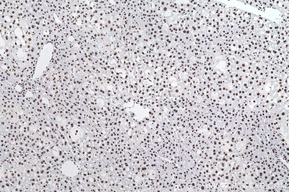 Immunohistochemical analysis of paraffin-embedded mouse liver tissue slide using KHC0870 (NUDT21 IHC Kit).