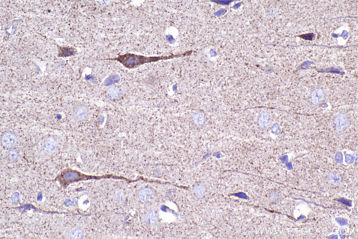 Immunohistochemical analysis of paraffin-embedded rat brain tissue slide using KHC2314 (NUDT6 IHC Kit).