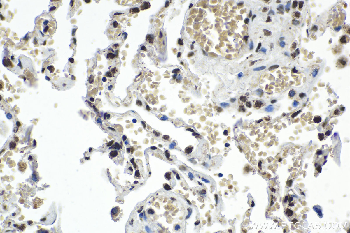 Immunohistochemical analysis of paraffin-embedded human lung tissue slide using KHC1984 (NUFIP1 IHC Kit).