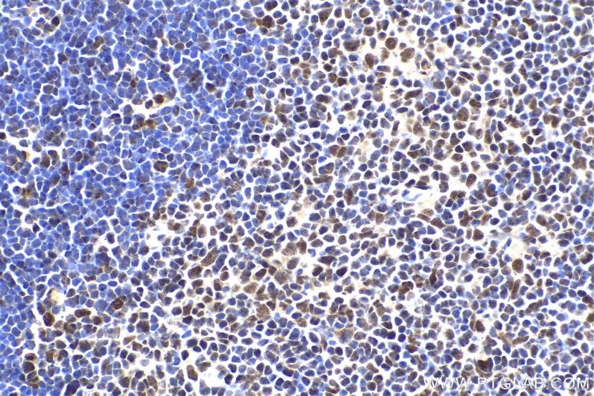 Immunohistochemical analysis of paraffin-embedded mouse thymus tissue slide using KHC1984 (NUFIP1 IHC Kit).