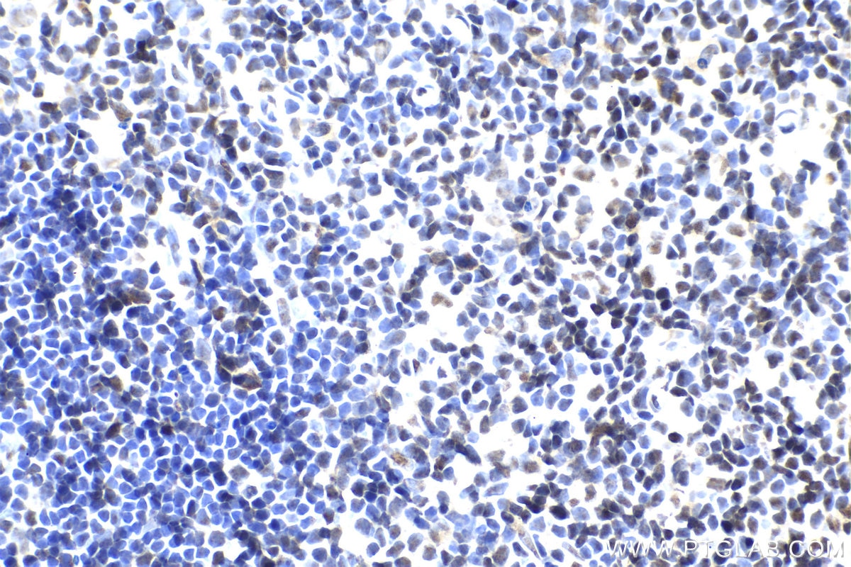 Immunohistochemical analysis of paraffin-embedded rat thymus tissue slide using KHC1984 (NUFIP1 IHC Kit).