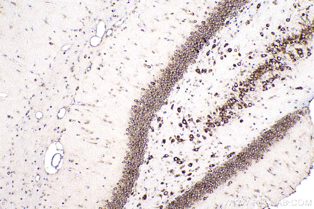 Immunohistochemical analysis of paraffin-embedded rat brain tissue slide using KHC0958 (NUFIP2 IHC Kit).