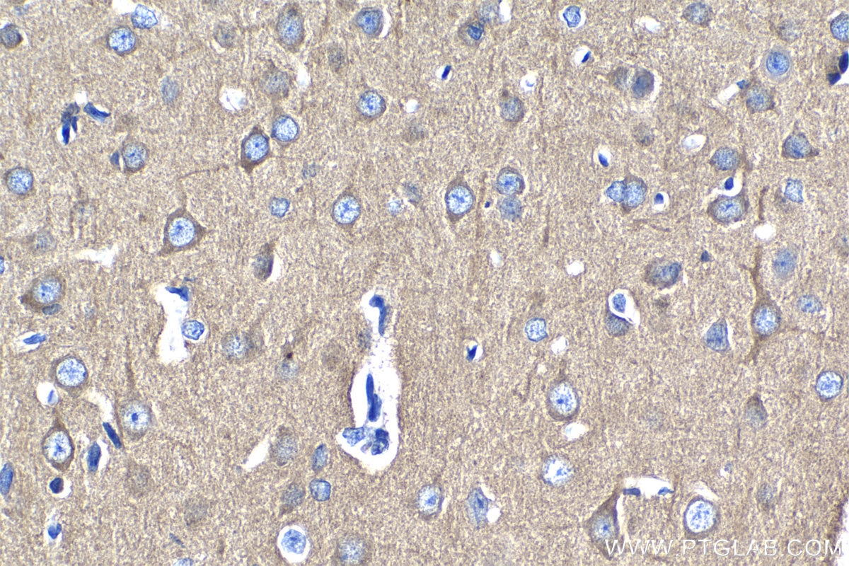 Immunohistochemical analysis of paraffin-embedded rat brain tissue slide using KHC1269 (NUMBL IHC Kit).