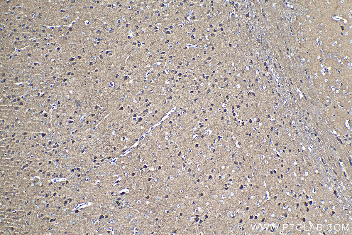 Immunohistochemical analysis of paraffin-embedded mouse brain tissue slide using KHC1269 (NUMBL IHC Kit).