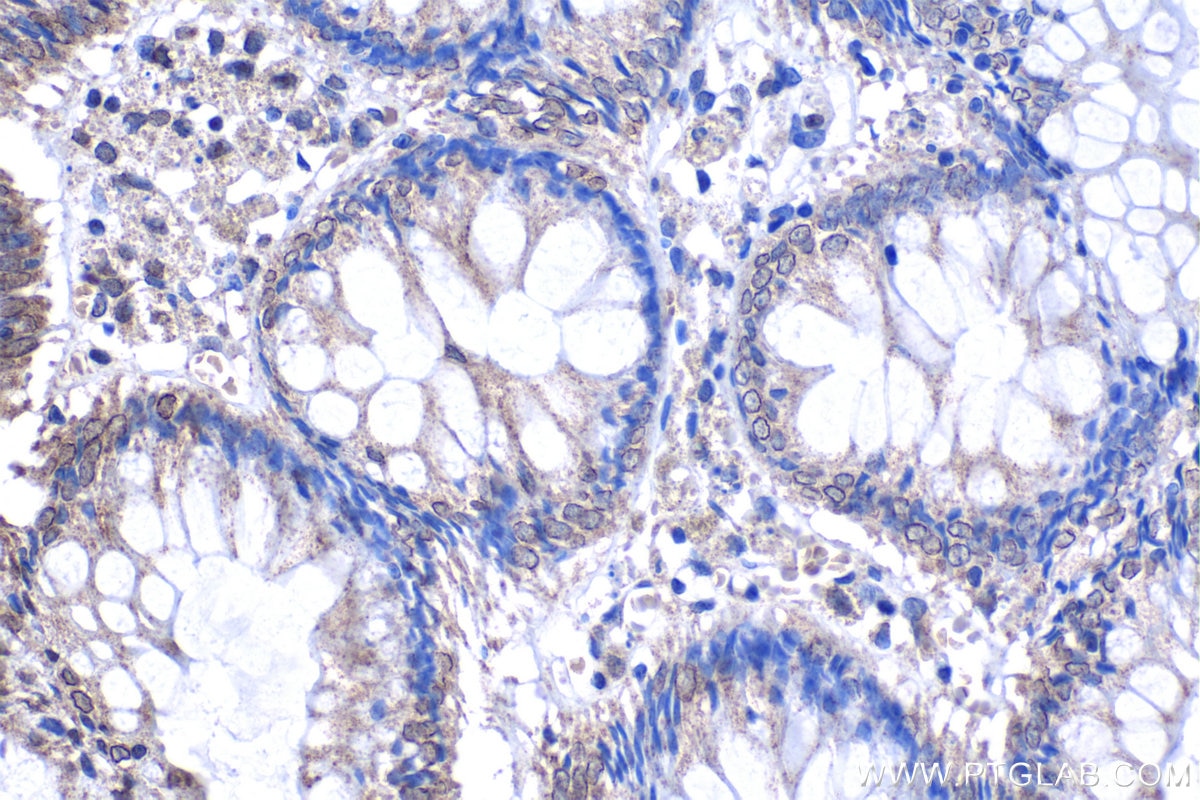 Immunohistochemical analysis of paraffin-embedded human colon tissue slide using KHC1199 (NUP133 IHC Kit).