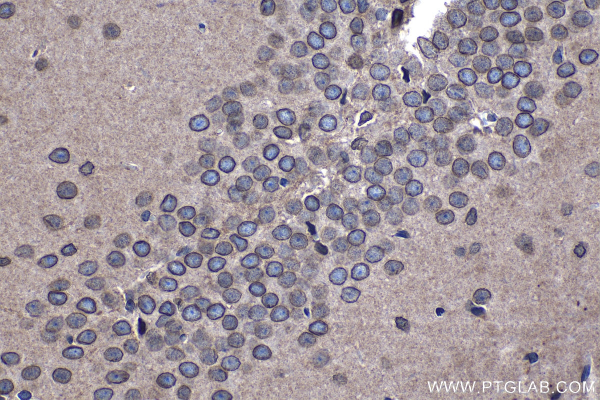 Immunohistochemical analysis of paraffin-embedded rat brain tissue slide using KHC1199 (NUP133 IHC Kit).