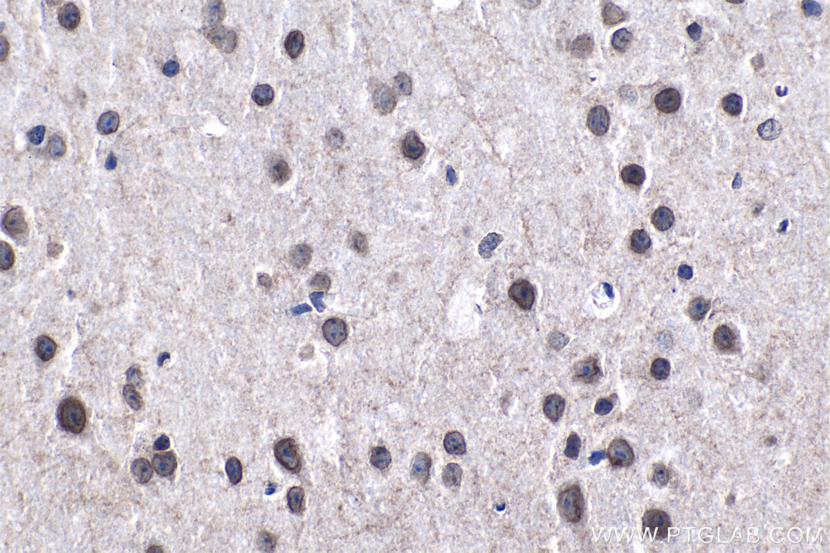 Immunohistochemical analysis of paraffin-embedded mouse brain tissue slide using KHC1199 (NUP133 IHC Kit).