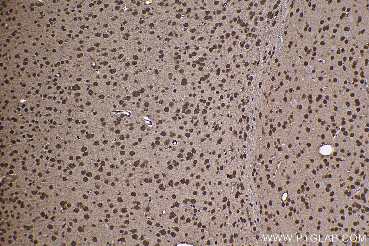 Immunohistochemical analysis of paraffin-embedded mouse brain tissue slide using KHC1200 (NUP214 IHC Kit).