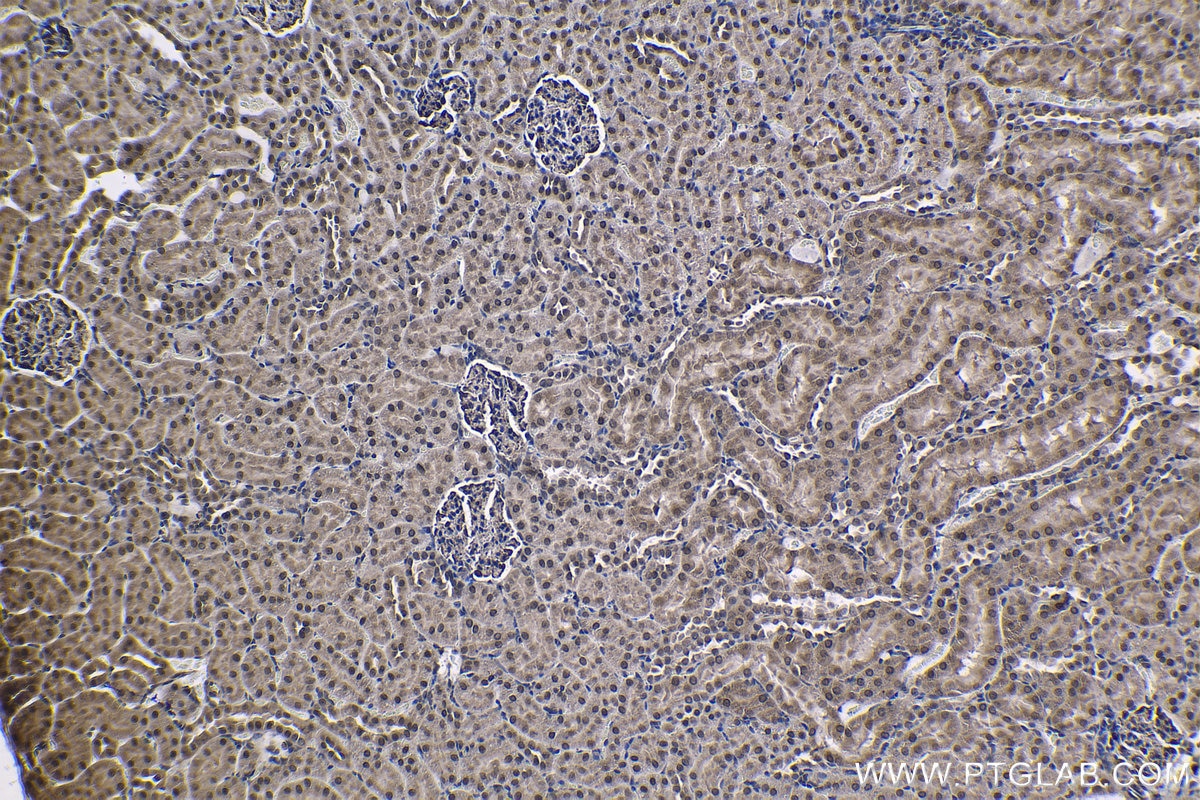 Immunohistochemical analysis of paraffin-embedded rat kidney tissue slide using KHC1200 (NUP214 IHC Kit).